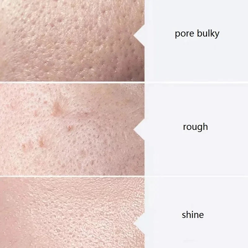 Kit de Sueros Faciales Aqua Peel AS1 SA2 AO3 - Solución Profesional para Limpieza Profunda 400ml (3 Sueros)