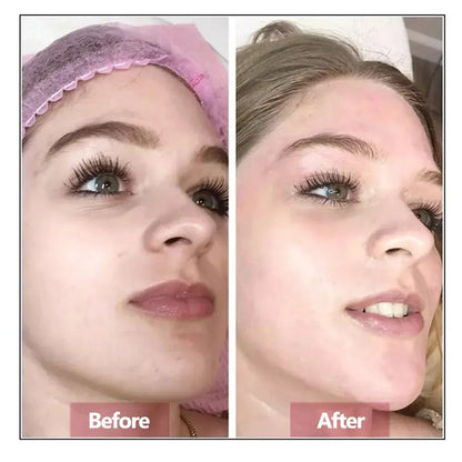 Sérum Facial de Ácido Hialurónico - Hidratante y Reparador Anti-Edad