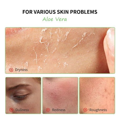 Set de Cuidado Facial con Aloe Vera - Hidratación Profunda y Nutrición Intensiva para Piel Luminosa