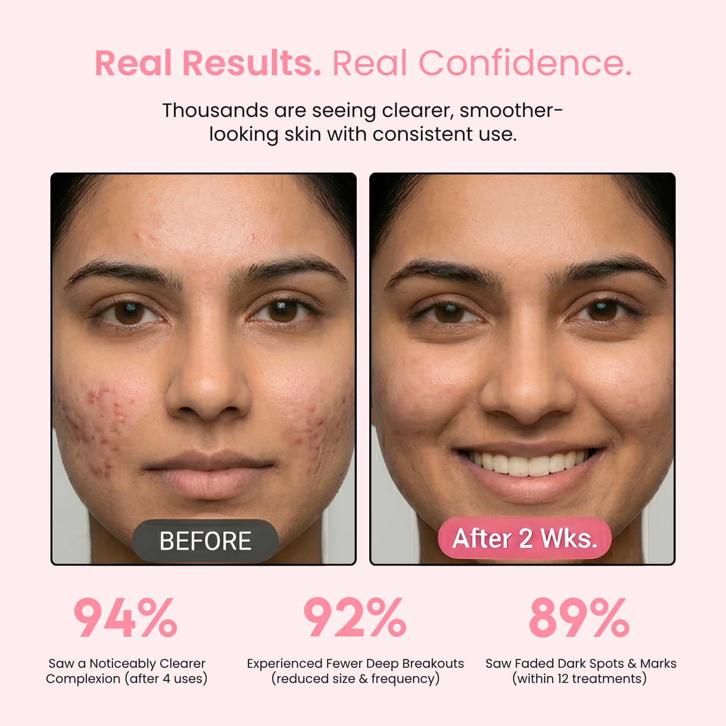 Avof High Frequency Facial Wand