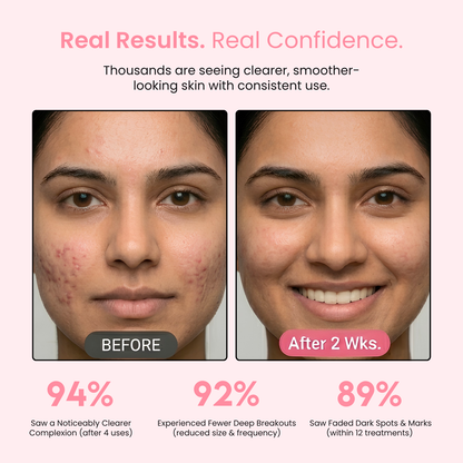 Avof High Frequency Facial Wand